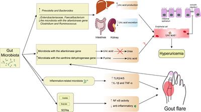 The role of gut microbiota in gout: Is gut microbiota a potential target for gout treatment